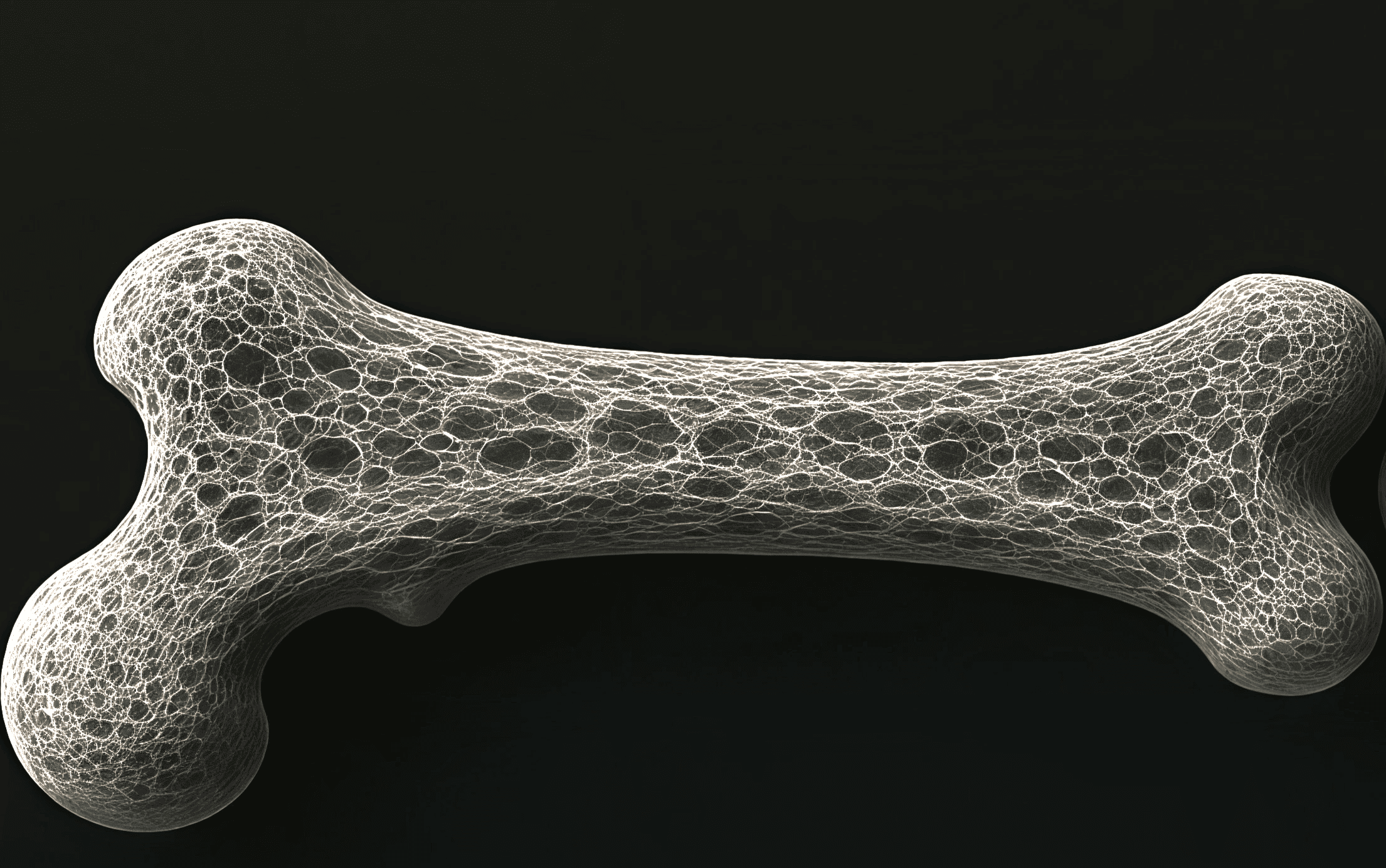 Imagem de ossos fracos por falta de vitamina D